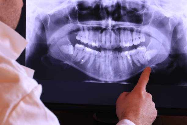 Best Emergency Denture Repair in Langley Park, MD